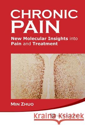 Chronic Pain: New Molecular Insights Into Pain and Treatment Min Zhuo 9789814324526 World Scientific Publishing Company - książka
