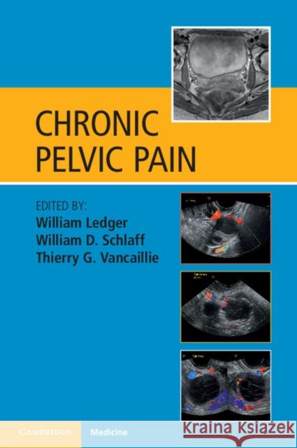 Chronic Pelvic Pain William Ledger & William D Schlaff 9781107636620 CAMBRIDGE UNIVERSITY PRESS - książka