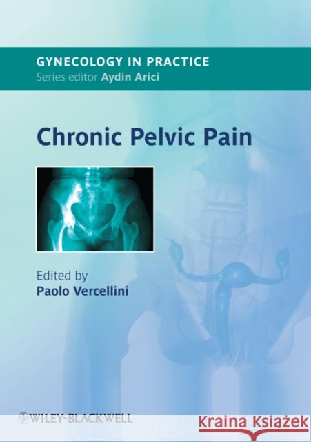 Chronic Pelvic Pain Paolo Vercellini   9781444330663  - książka