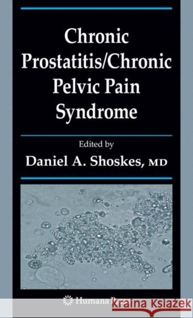 Chronic Prostatitis/Chronic Pelvic Pain Syndrome Daniel A. Shoskes 9781617379260 Springer - książka