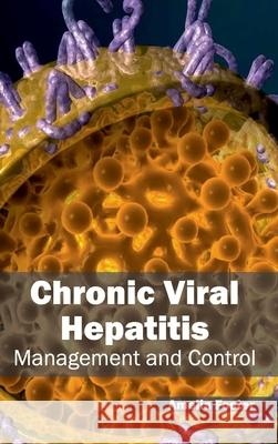 Chronic Viral Hepatitis: Management and Control Amelia Foster 9781632420794 Foster Academics - książka