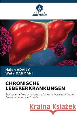 Chronische Lebererkrankungen Najeh Adaily Wafa Dahmani  9786205891476 Verlag Unser Wissen - książka