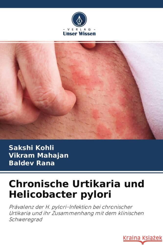 Chronische Urtikaria und Helicobacter pylori Kohli, Sakshi; Mahajan, Vikram; Rana, Baldev 9786202745222 Verlag Unser Wissen - książka