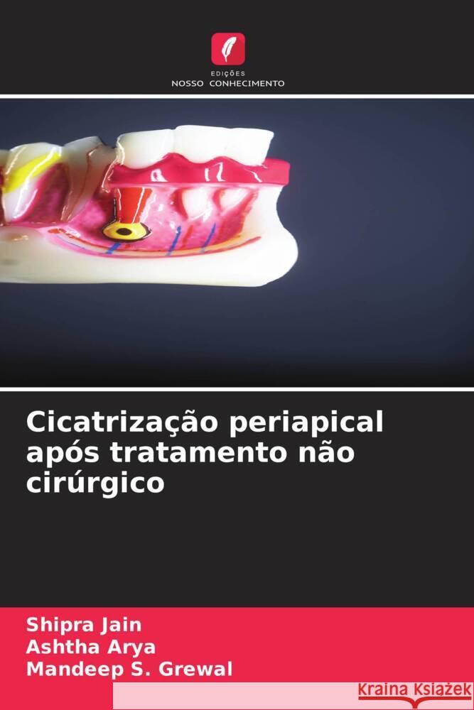 Cicatriza??o periapical ap?s tratamento n?o cir?rgico Shipra Jain Ashtha Arya Mandeep S. Grewal 9786207356294 Edicoes Nosso Conhecimento - książka