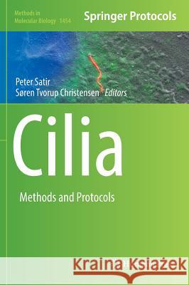 Cilia: Methods and Protocols Satir, Peter 9781493937875 Humana Press - książka