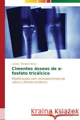 Cimentos ósseos de α-fosfato tricálcico Morejón Alonso Loreley 9783639744149 Novas Edicoes Academicas - książka