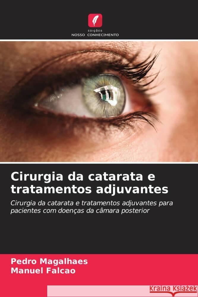 Cirurgia da catarata e tratamentos adjuvantes Magalhaes, Pedro, Falcão, Manuel 9786208234911 Edições Nosso Conhecimento - książka