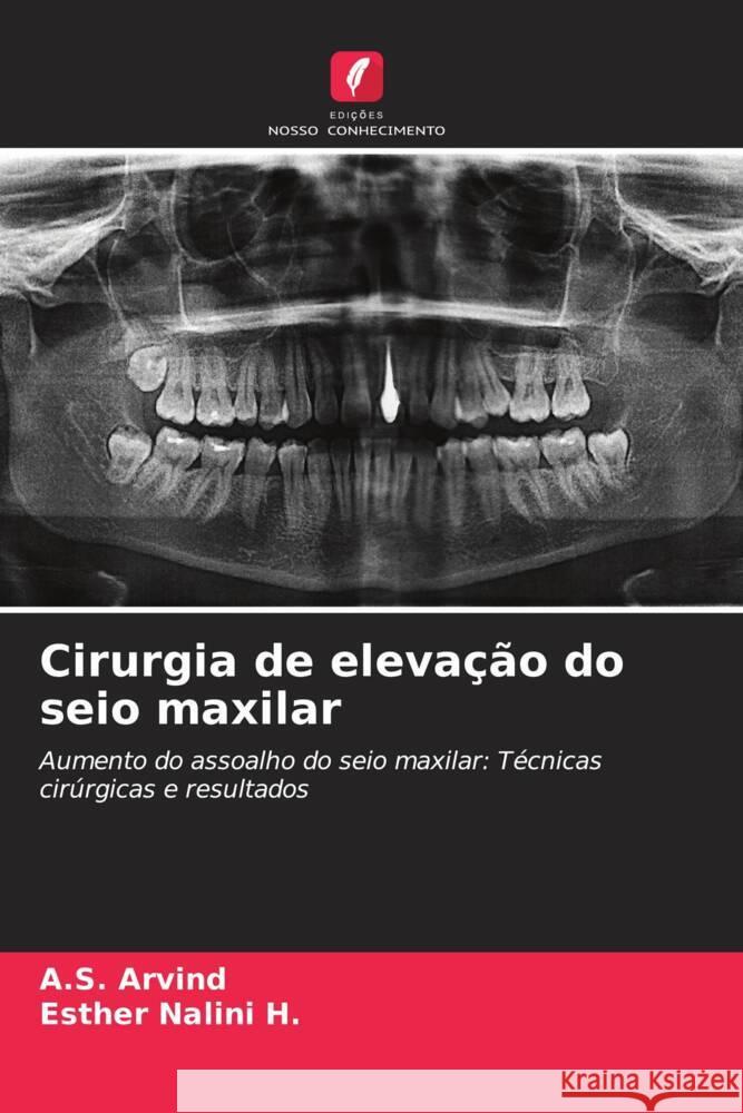 Cirurgia de elevação do seio maxilar Arvind, A.S., Nalini H., Esther 9786208268213 Edições Nosso Conhecimento - książka