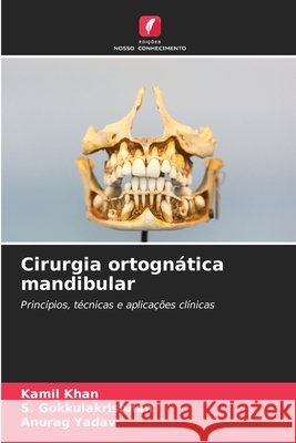 Cirurgia ortognática mandibular Khan, Kamil, Gokkulakrishnan, S., Yadav, Anurag 9786208799120 Edições Nosso Conhecimento - książka
