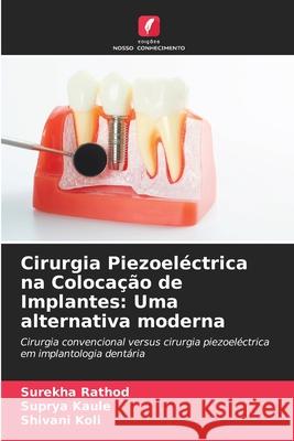 Cirurgia Piezoeléctrica na Colocação de Implantes: Uma alternativa moderna Rathod, Surekha, Kaule, Suprya, KOLI, SHIVANI 9786208753542 Edições Nosso Conhecimento - książka