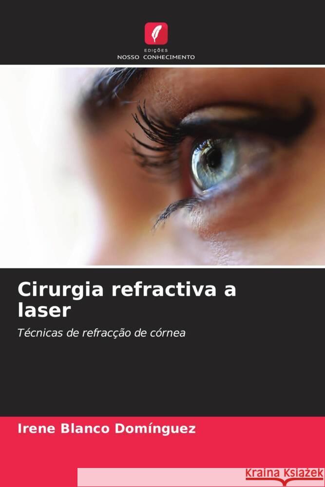 Cirurgia refractiva a laser Blanco Domínguez, Irene 9786205558607 Edições Nosso Conhecimento - książka