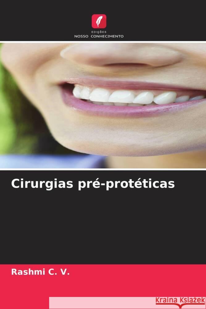 Cirurgias pré-protéticas C. V., Rashmi 9786206509875 Edições Nosso Conhecimento - książka