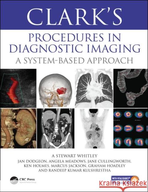 Clark's Diagnostic Imaging Procedures: A System Based Approach Whitley                                  Edward Holmes Ansbro 9781444137224 CRC Press - książka
