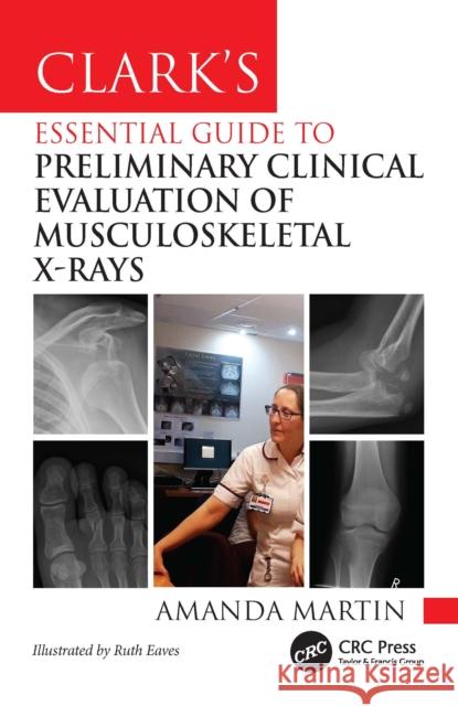 Clark's Essential Guide to Musculoskeletal X-Ray Interpretation for Radiographers: Evaluating and Commenting on Images Amanda Martin 9781032832920 CRC Press - książka