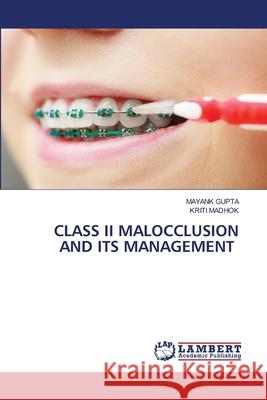 Class II Malocclusion and Its Management Mayank Gupta Kriti Madhok 9786203582086 LAP Lambert Academic Publishing - książka