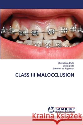 Class III Malocclusion Shuvadeep Dutta, Puneet Batra, Sreevatsan Raghavan 9786202802208 LAP Lambert Academic Publishing - książka