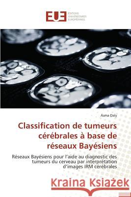 Classification de Tumeurs Cérébrales À Base de Réseaux Bayésiens Daly-A 9783841748478 Editions Universitaires Europeennes - książka