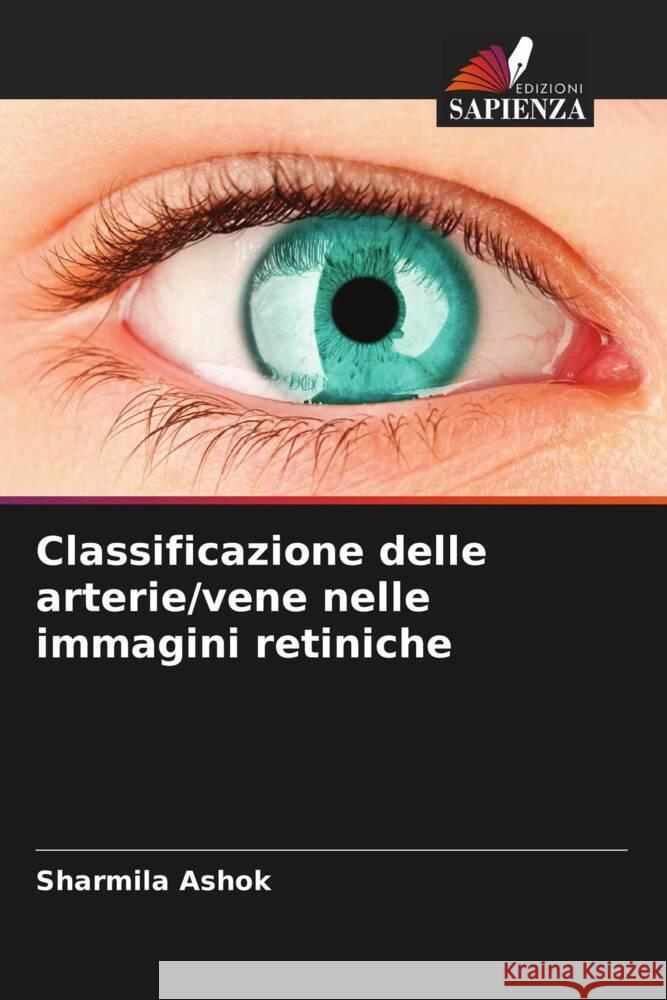 Classificazione delle arterie/vene nelle immagini retiniche Ashok, Sharmila 9786205205969 Edizioni Sapienza - książka