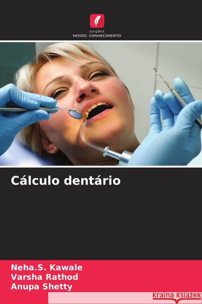 Cálculo dentário Kawale, Neha.S., Rathod, Varsha, Shetty, Anupa 9786204795263 Edições Nosso Conhecimento - książka