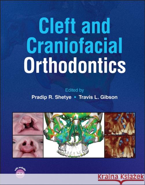 Cleft and Craniofacial Orthodontics  9781119778349  - książka