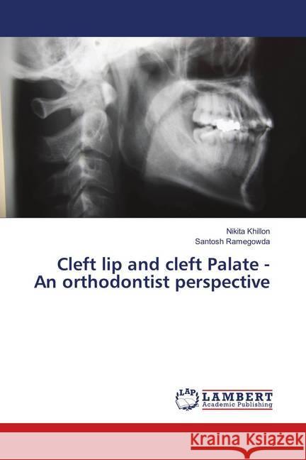 Cleft lip and cleft Palate - An orthodontist perspective Khillon, Nikita; Ramegowda, Santosh 9783659907401 LAP Lambert Academic Publishing - książka