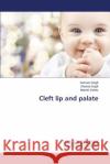 Cleft lip and palate Singh Sameer 9783659627750 LAP Lambert Academic Publishing