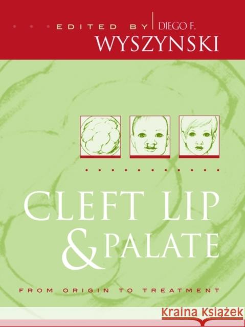 Cleft Lip and Palate: From Origin to Treatment Wyszynski, Diego F. 9780195139068 Oxford University Press, USA - książka