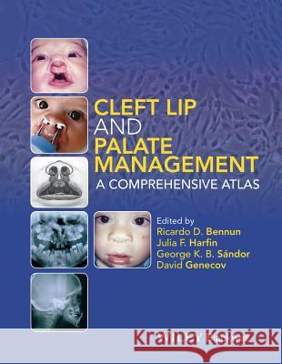 Cleft Lip and Palate Management: A Comprehensive Atlas Bennun, Ricardo D. 9781118607541 Wiley-Blackwell - książka