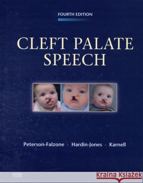 Cleft Palate Speech Sally Peterson-Falzone 9780323048828  - książka