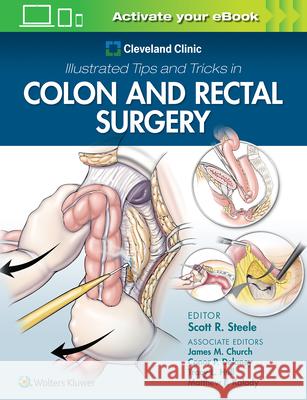 Cleveland Clinic Illustrated Tips and Tricks in Colon and Rectal Surgery Scott Steele 9781975108250 LWW - książka