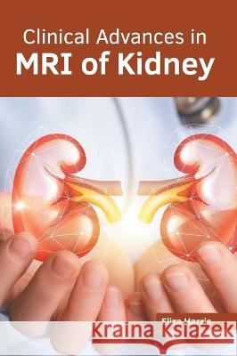 Clinical Advances in MRI of Kidney Eliza Harris 9781639871100 Murphy & Moore Publishing - książka