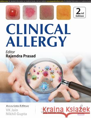 Clinical Allergy Rajendra Prasad 9789356966581 Jaypee Brothers Medical Publishers - książka