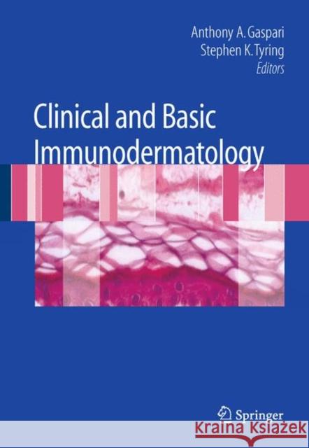 Clinical and Basic Immunodermatology Gaspari 9781848828513 SPRINGER - książka