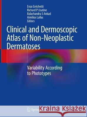 Clinical and Dermoscopic Atlas of Non-Neoplastic Dermatoses: Variability According to Phototypes Enzo Errichetti Richard P. Usatine Balachandra S. Ankad 9783031196874 Springer - książka