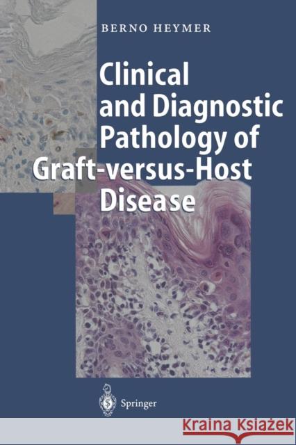 Clinical and Diagnostic Pathology of Graft-Versus-Host Disease Heymer, Berno 9783642087219 Springer - książka