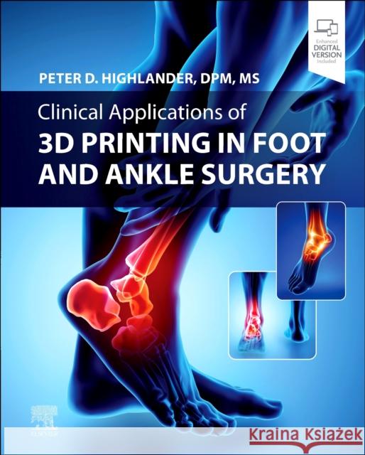 Clinical Applications of 3D Printing in Foot and Ankle Surgery Peter D. Highlander 9780323825658 Elsevier - książka