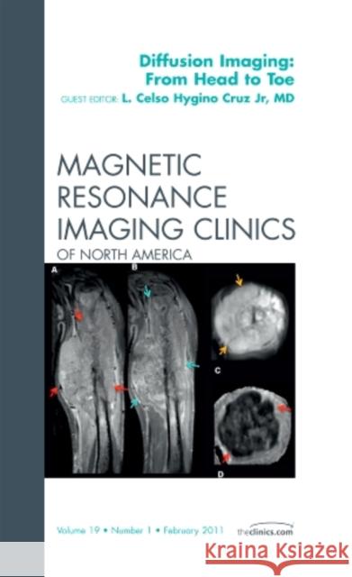 Clinical Applications of Diffusion Imaging: from Head to Toe, An Issue of Magnetic Resonance Imaging Clinics Hygino, Celso 9781455704668  - książka