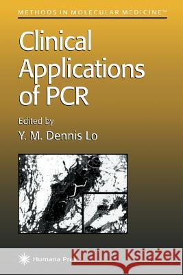 Clinical Applications of PCR Y. M. Dennis Lo Y. M. Dennis Lo Y. M. Dennis Lo 9780896033597 Humana Press - książka
