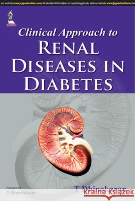 Clinical Approach to Renal Diseases in Diabetes Tikus Dinakaran 9789351525721 JP Medical Ltd - książka