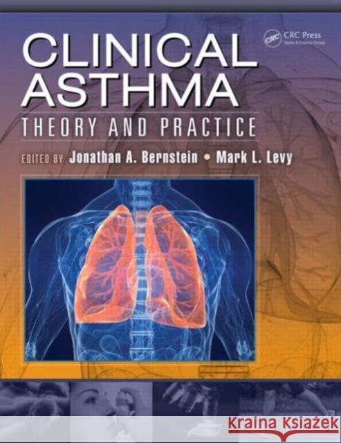 Clinical Asthma: Theory and Practice Bernstein, Jonathan 9781466585614 CRC Press - książka