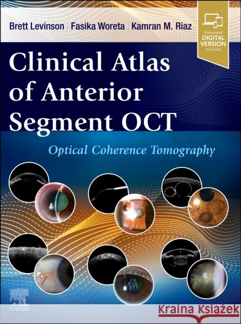 Clinical Atlas of Anterior Segment OCT: Optical Coherence Tomography  9780443120466 Elsevier Health Sciences - książka