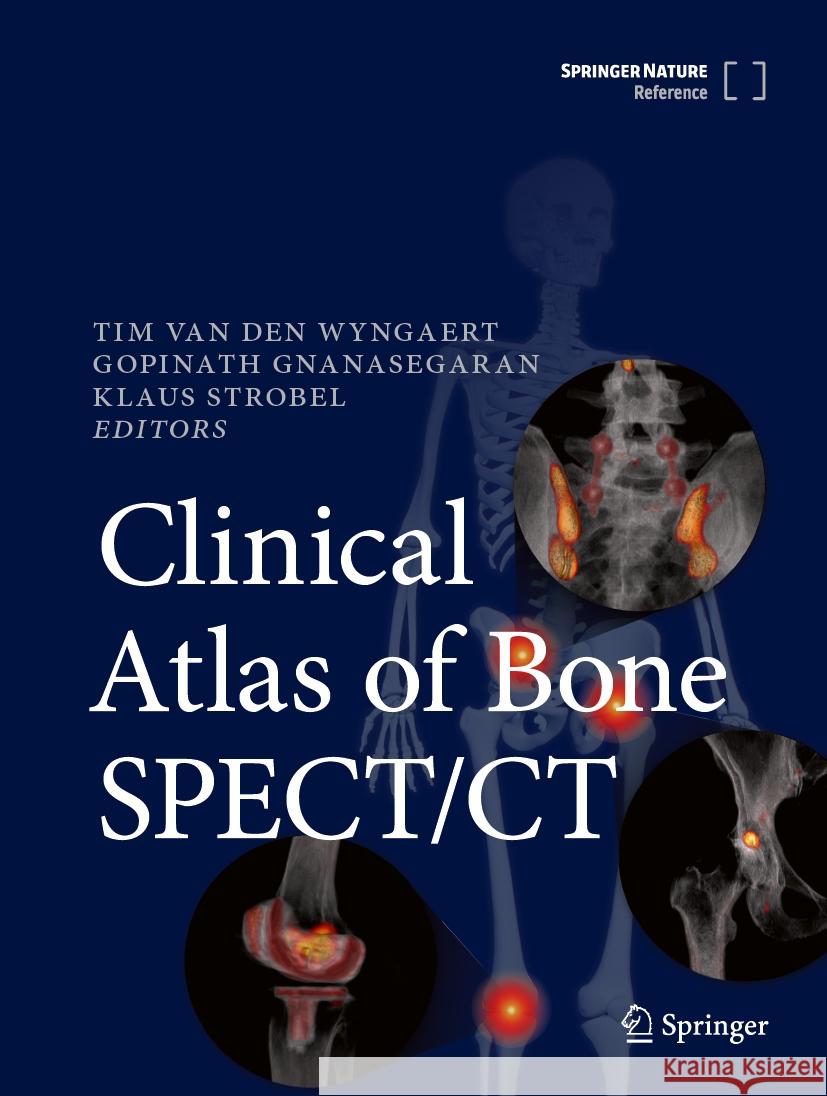 Clinical Atlas of Bone SPECT/CT Tim Va Gopinath Gnanasegaran Klaus Strobel 9783031264481 Springer - książka