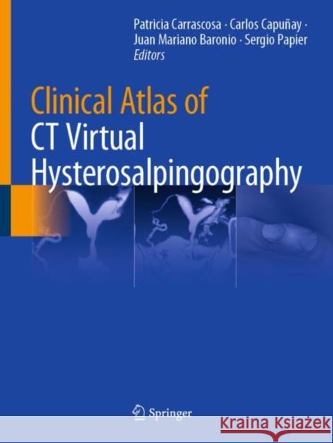 Clinical Atlas of CT Virtual Hysterosalpingography Patricia Carrascosa Carlos Capu 9783030662066 Springer - książka