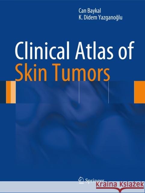 Clinical Atlas of Skin Tumors Can Baykal K. Didem Yazgan 9783642409370 Springer - książka