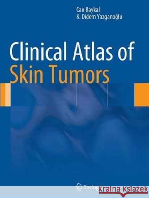 Clinical Atlas of Skin Tumors Can Baykal K. Didem Yazgan Kurtulus Didem Yazganoglu 9783662508510 Springer - książka