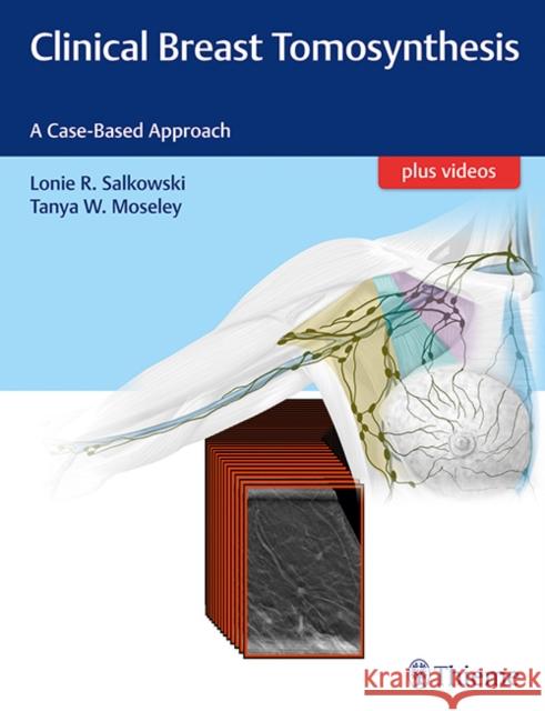 Clinical Breast Tomosynthesis: A Case-Based Approach Salkowski, Lonie R. 9781626232082 Thieme Medical Publishers - książka