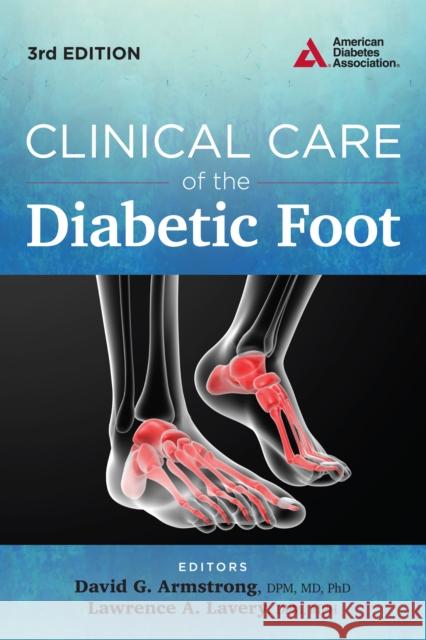 Clinical Care of the Diabetic Foot David G. Armstrong Lawrence A. Lavery 9781580405706 American Diabetes Association - książka