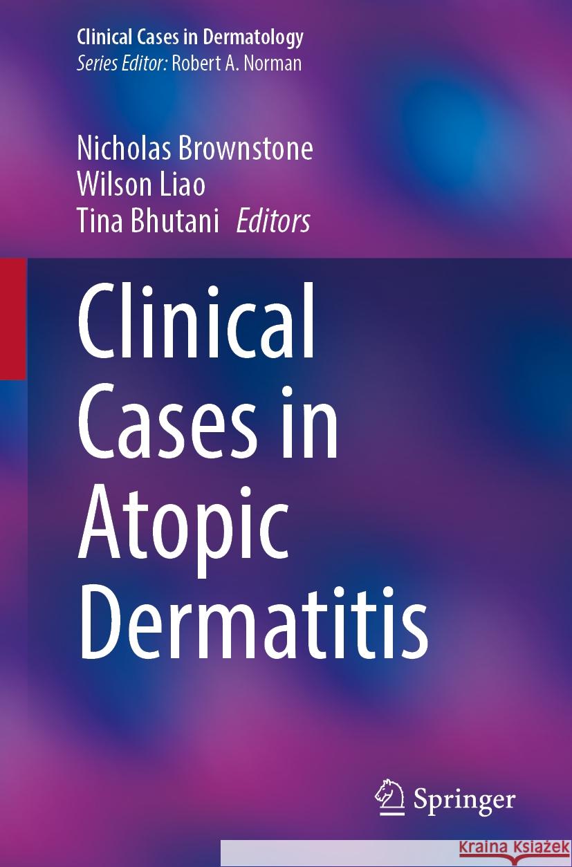 Clinical Cases in Atopic Dermatitis Nicholas Brownstone Wilson Liao Tina Bhutani 9783031521461 Springer - książka