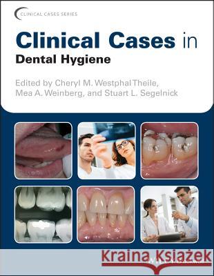 Clinical Cases in Dental Hygiene Cheryl M. Westpha Mea A. Weinberg Stuart L. Segelnick 9781119145028 Wiley-Blackwell - książka