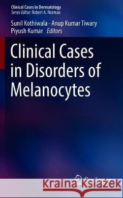 Clinical Cases in Disorders of Melanocytes Sunil Kothiwala Anup Kuma Piyush Kumar 9783030227562 Springer - książka